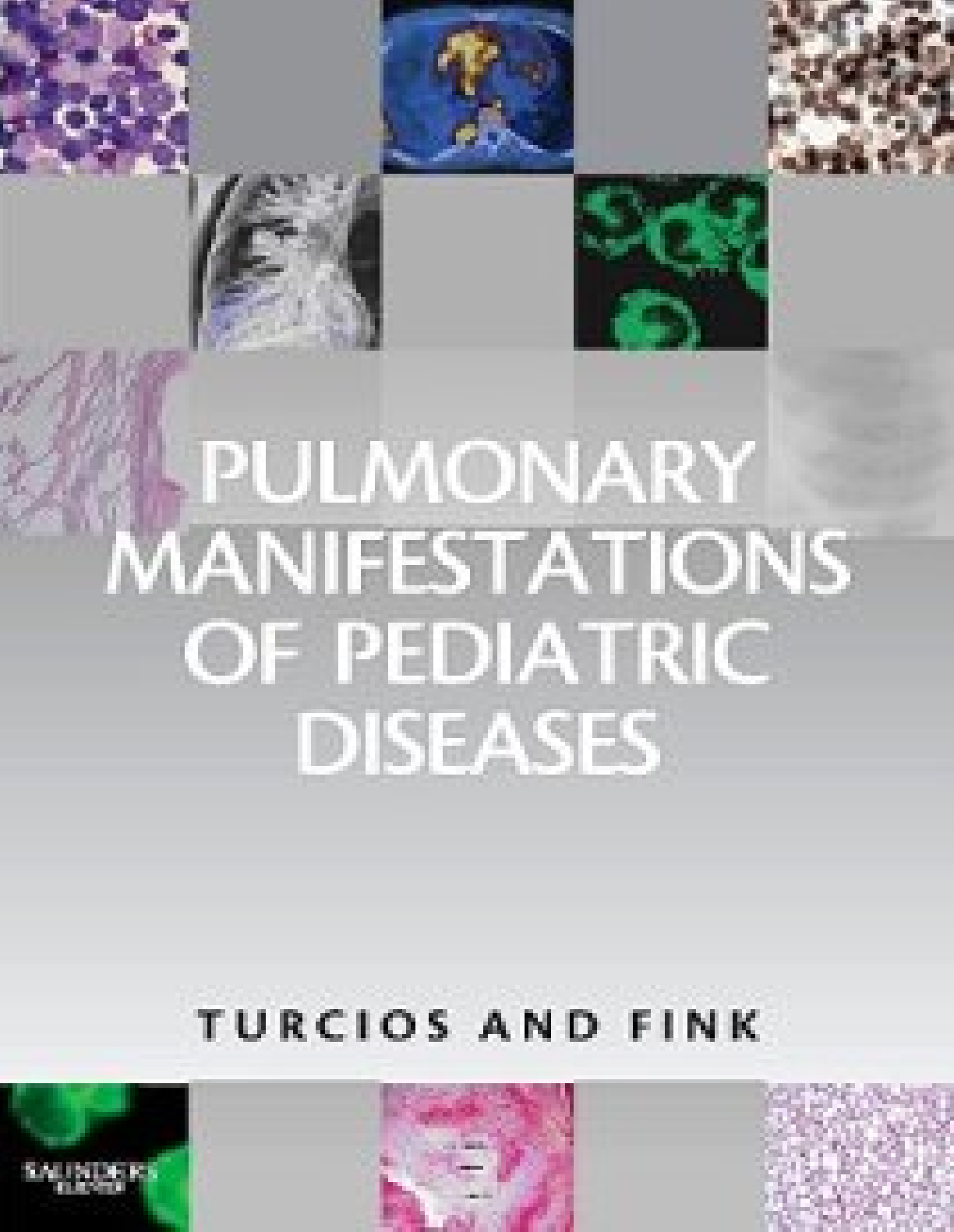 CanapÃ© De Jardin Bois Beau Pulmonary Manifestations Of Pediatric Diseases [pdf Document]