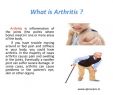 CanapÃ© RÃ©sine TressÃ©e Luxe How to Recover From Arthritis In Physiotherapy