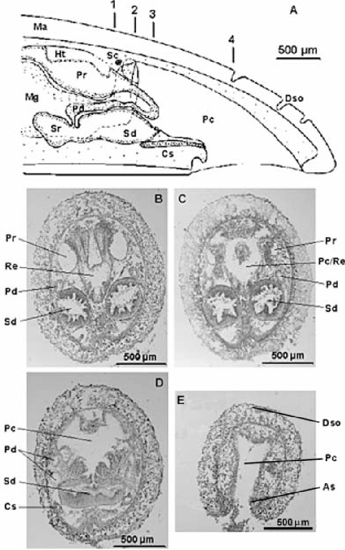 A Schematic cross sections through posterior body of Dorymenia hesperidesi sp nov As